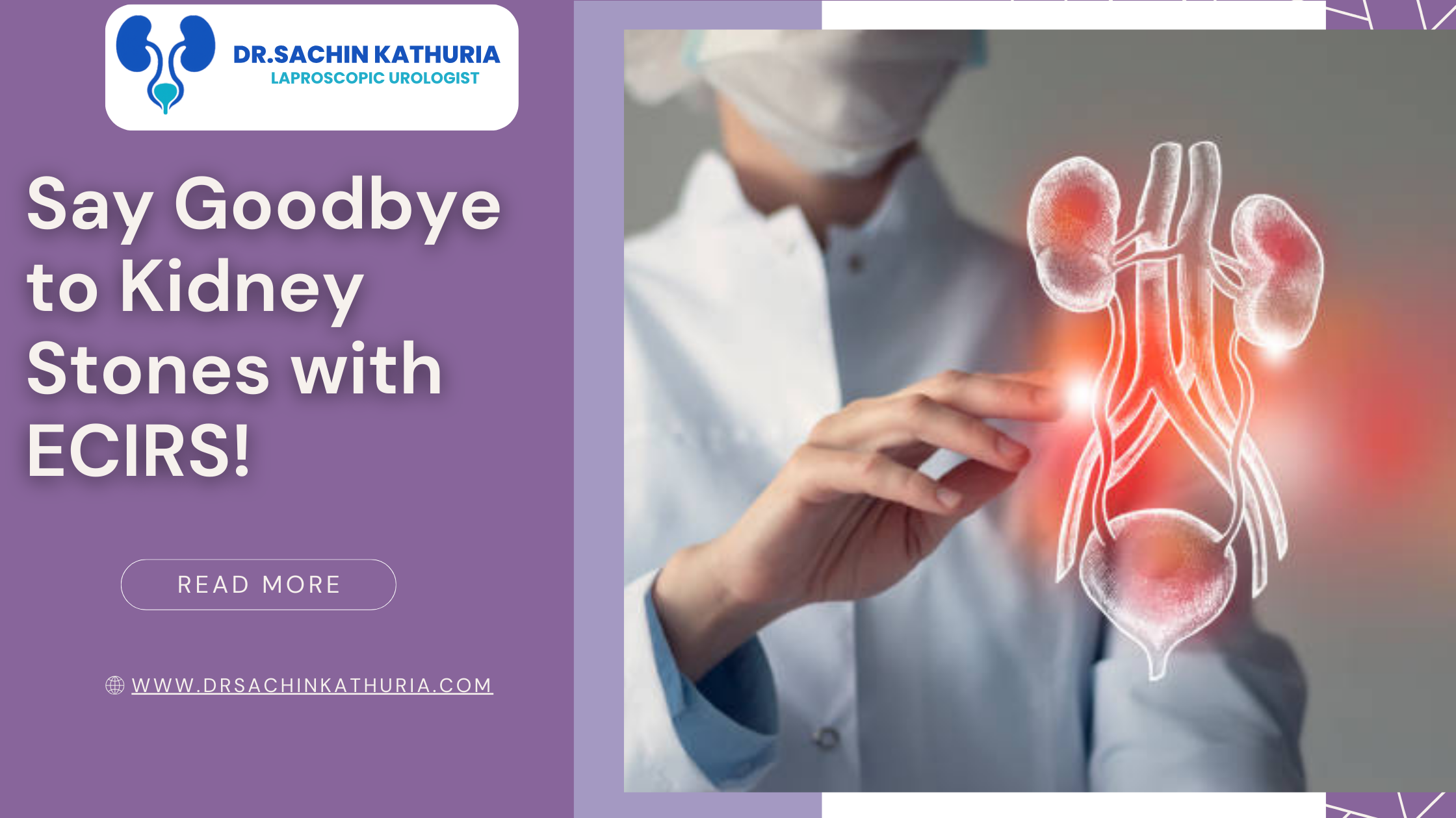 Say Goodbye to Kidney Stones with ECIRS!