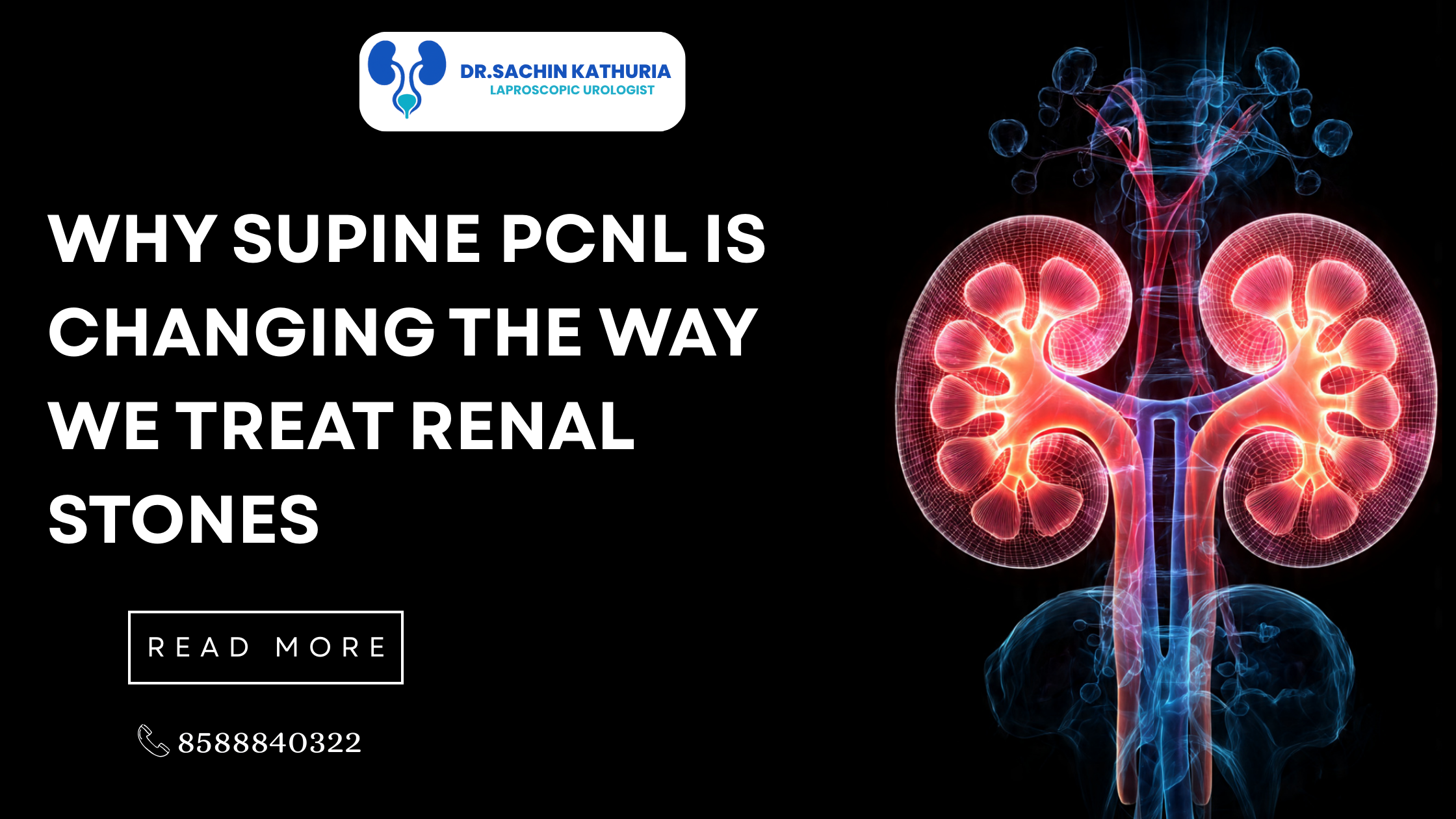 Why SUPINE PCNL Is Changing the Way We Treat Renal Stones