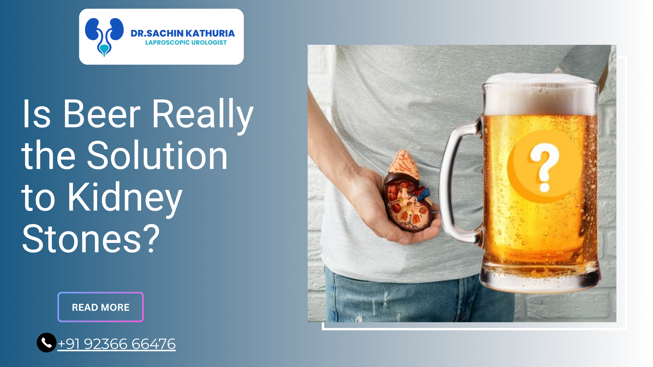 Is Beer Really the Solution to Kidney Stones?