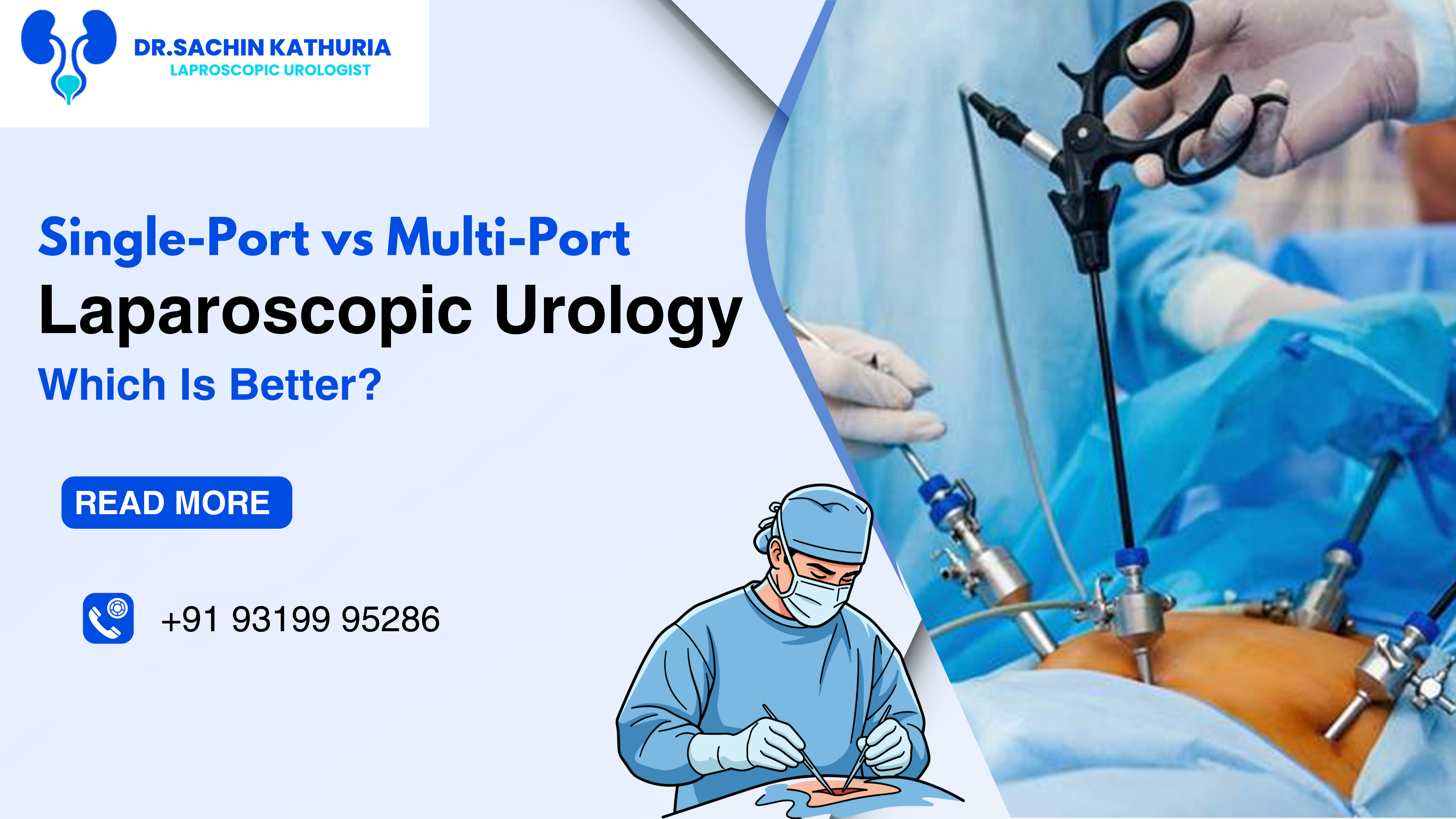 Single-Port vs Multi-Port Laparoscopic Urology: Which Is Better?