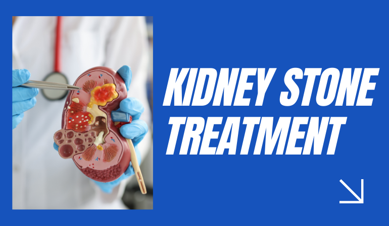 Kidney Stone Treatment